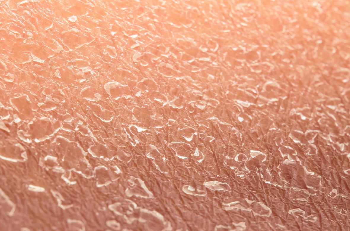 Idrata la tua pelle secca con la crema viso stella cosmetici