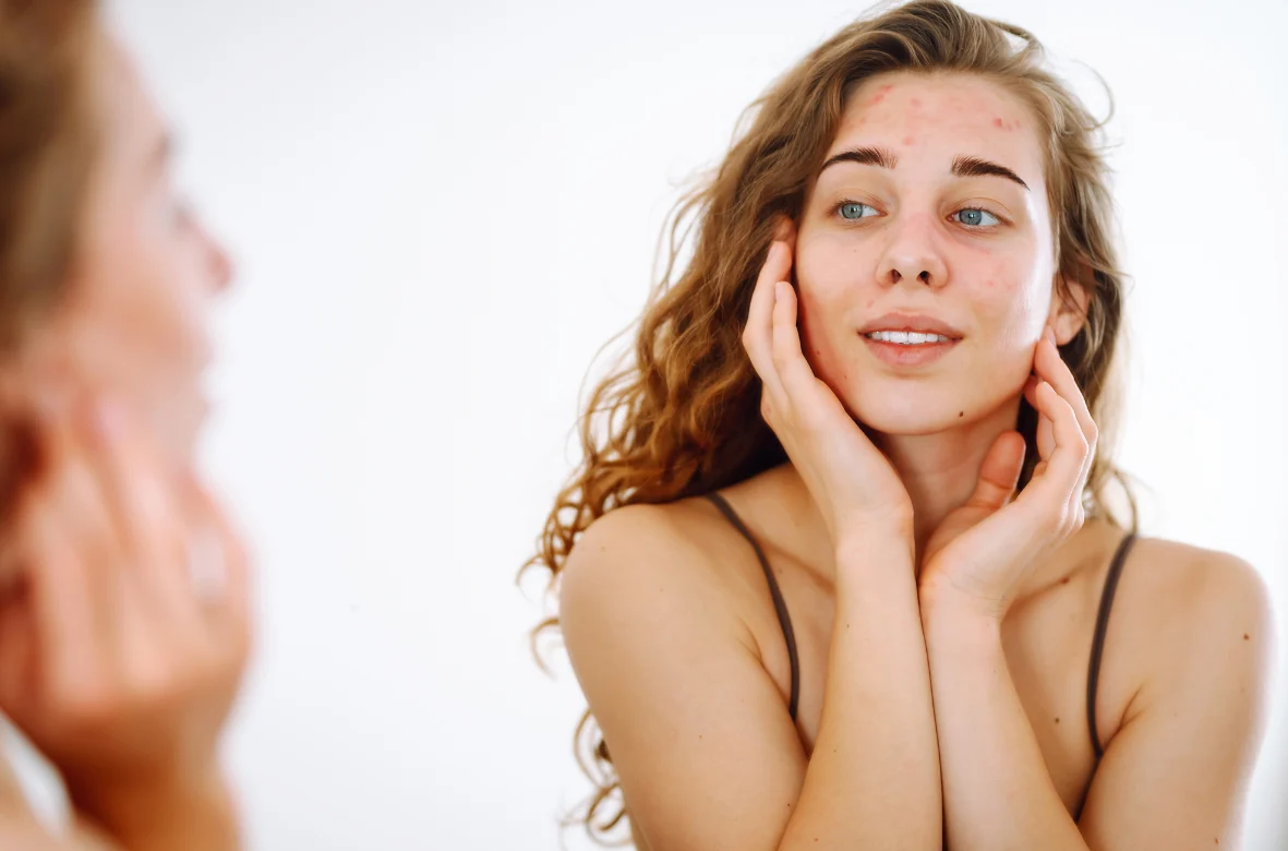 La primavera porta con se allergie, che possono presentarsi anche come rossori o infiammazioni della pelle